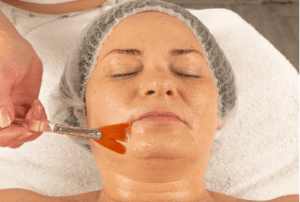 Thesera kezelés ára