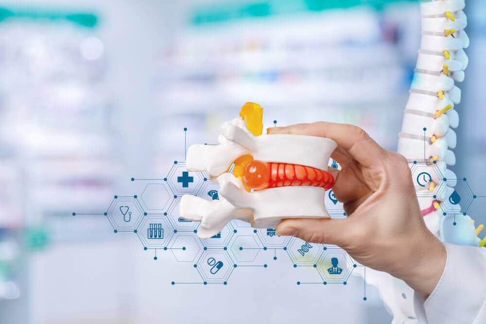 csigolya kopás gyógyítása